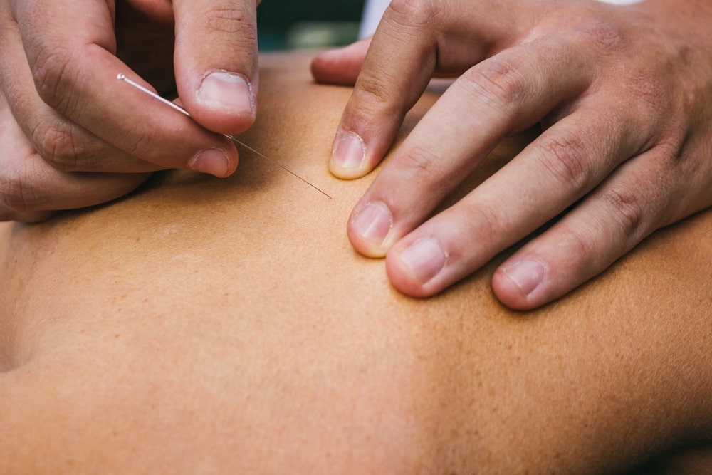 Massage Therapy for Trigger Points: What Physical Therapists Want You to  Know